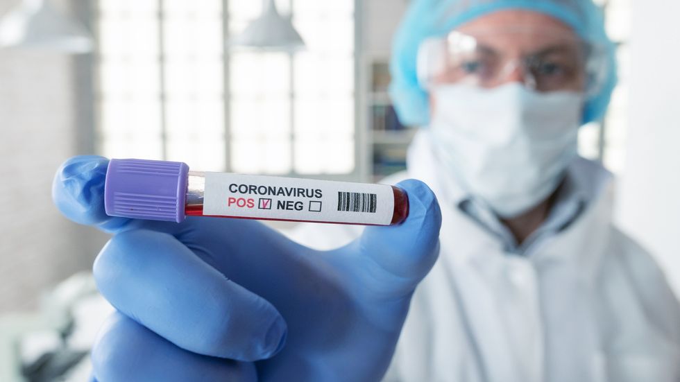 Coronavirus Is Killing More Men Than Women