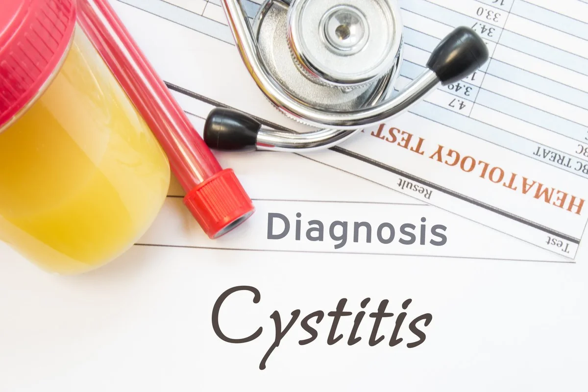 Cystitis diagnosis.