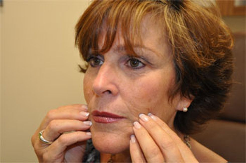 dermal fillers - carolyn