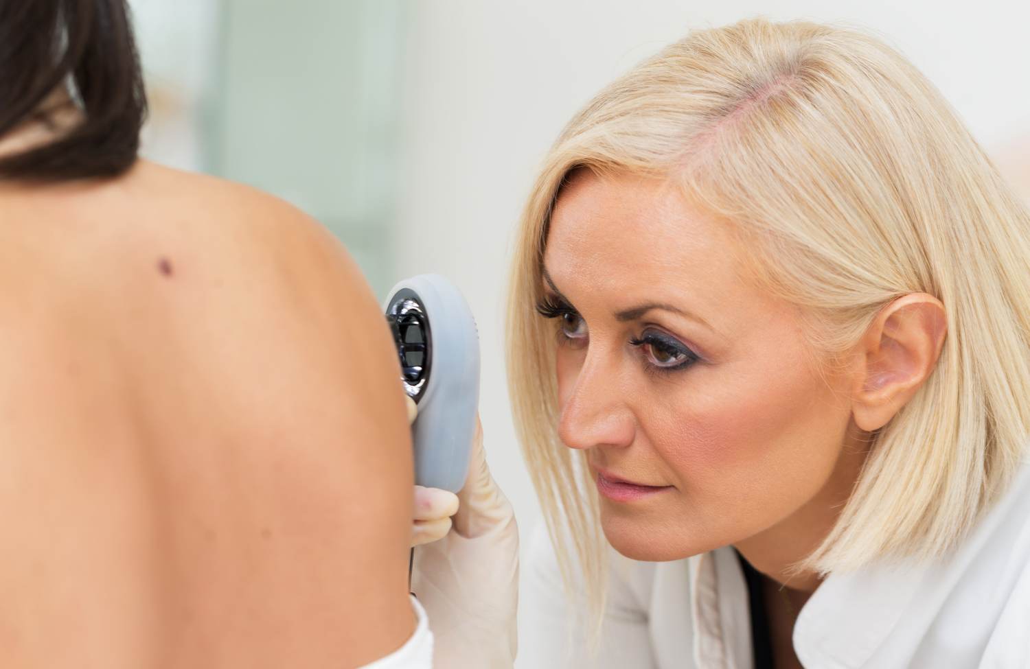 Skin Tags: An External Indicator of Your Internal Health