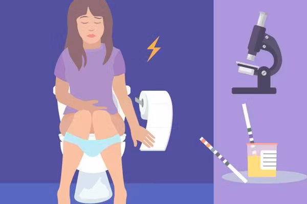 Diagnosing Urothelial Bladder Cancer (UBC) infographic