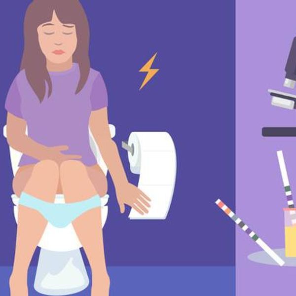 Diagnosing Urothelial Bladder Cancer (UBC) infographic