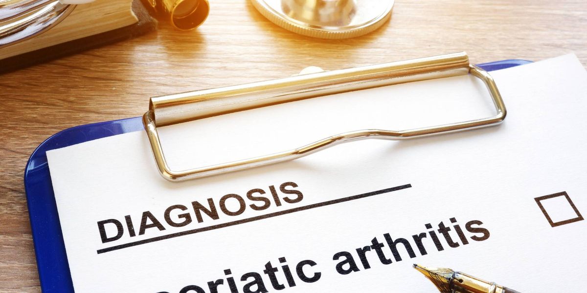 Información básica de la artritis psoriásica