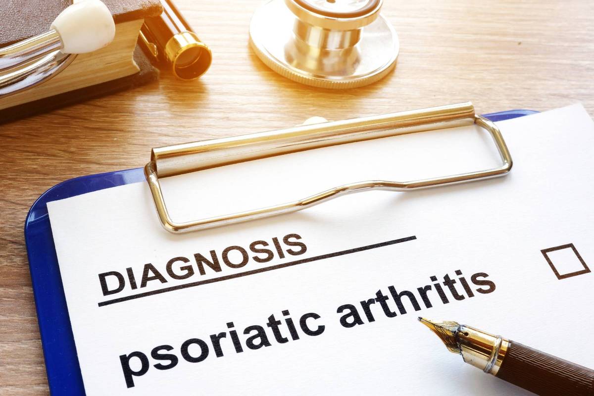 Diagnosis psoriatic arthritis and clipboard
