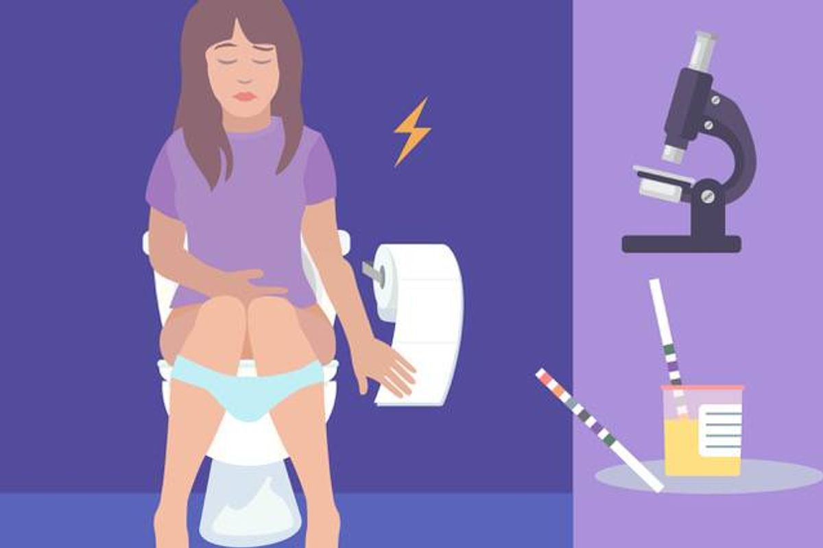 Diagnóstico del cáncer de vejiga urotelial (UBC)