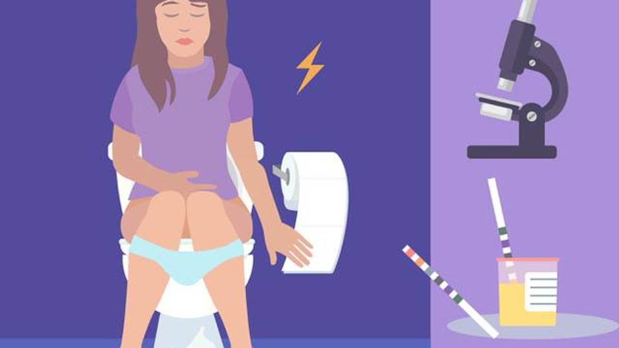 Diagnóstico del cáncer de vejiga urotelial (UBC)