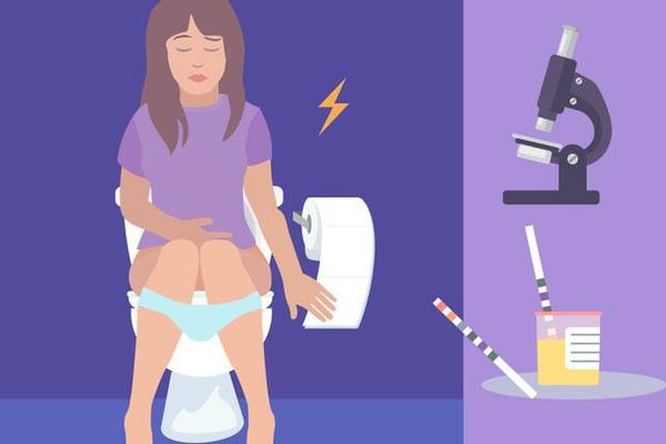 Diagnóstico del cáncer de vejiga urotelial (UBC)