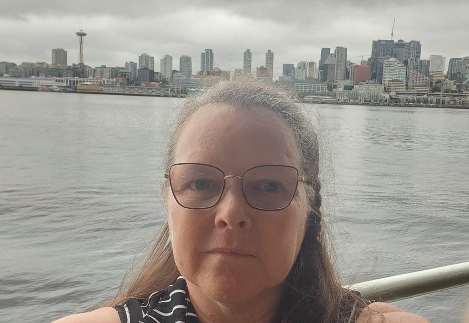 Doctors Told Me It Was Just Perimenopause. It Turned Out to Be Uterine Fibroids.
