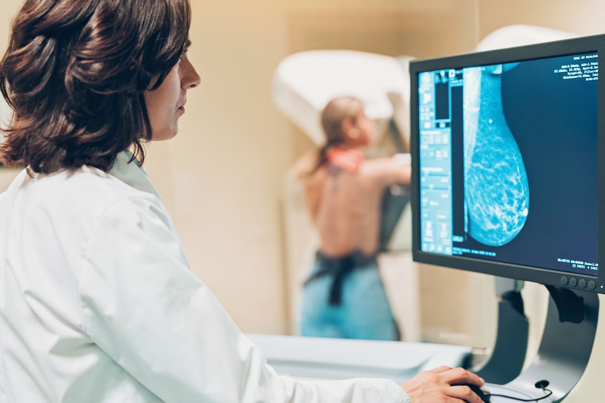 Do You Have Dense Breasts? Knowing Your Status Could Make a Difference in Your Breast Cancer Screening