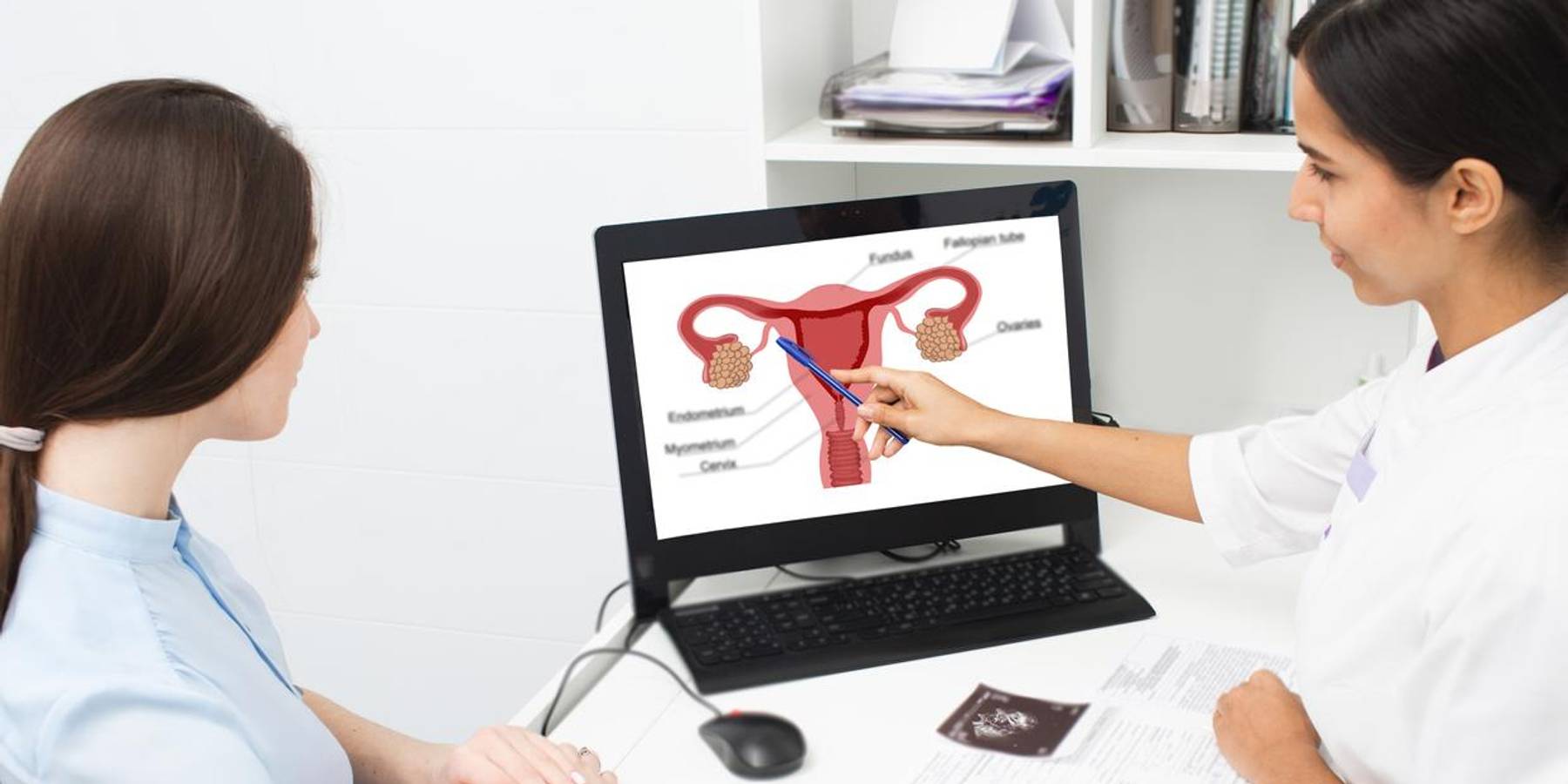 Doctor and patient looking at fibroids on a computer screen