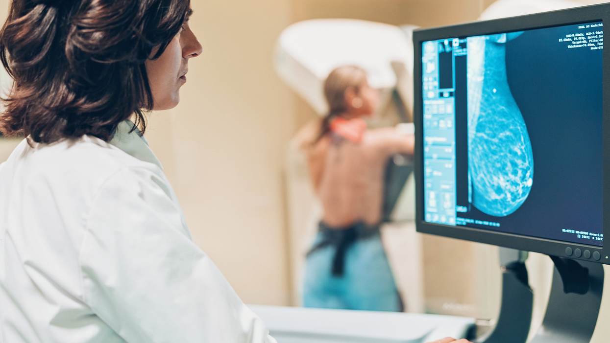 Do You Have Dense Breasts? Knowing Your Status Could Make a Difference in Your
Breast Cancer Screening