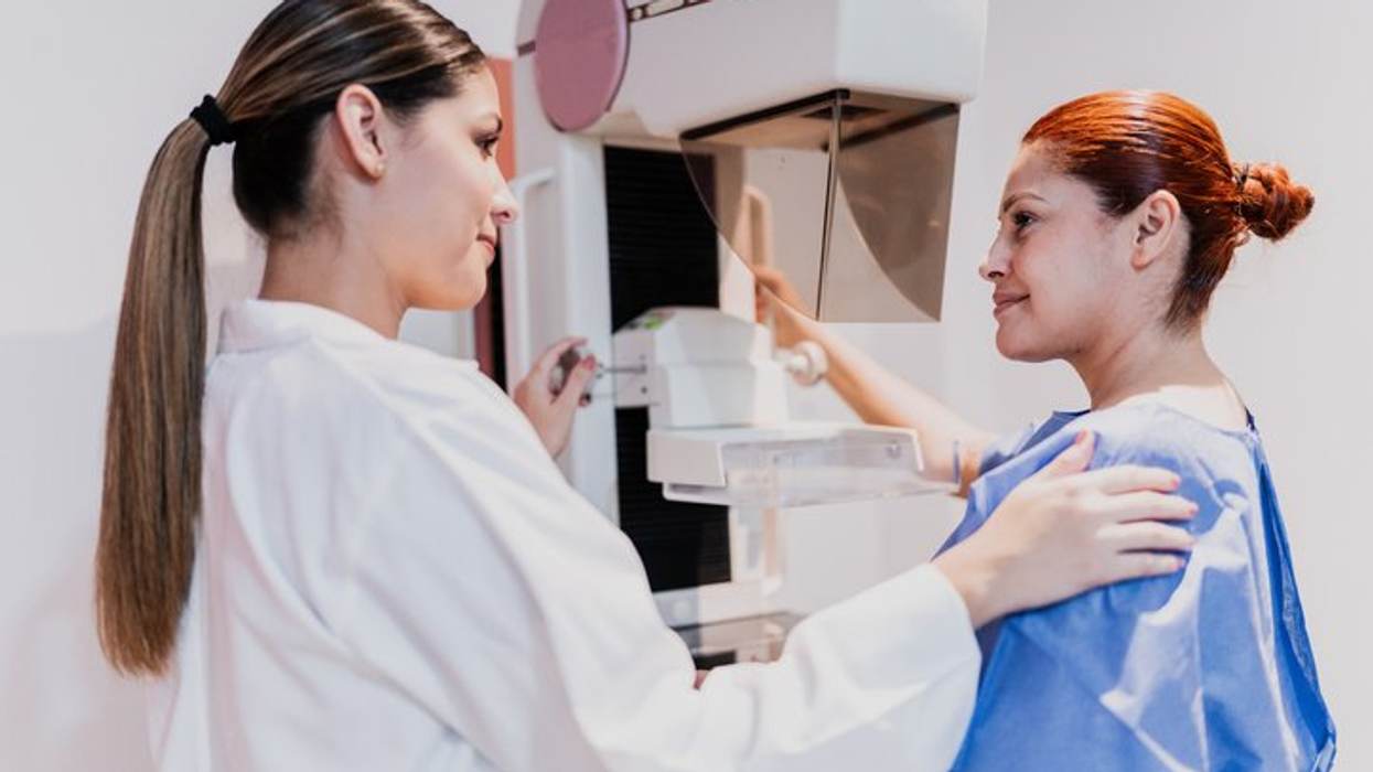 Entendiendo el CDIS: Cáncer de mama de etapa temprana