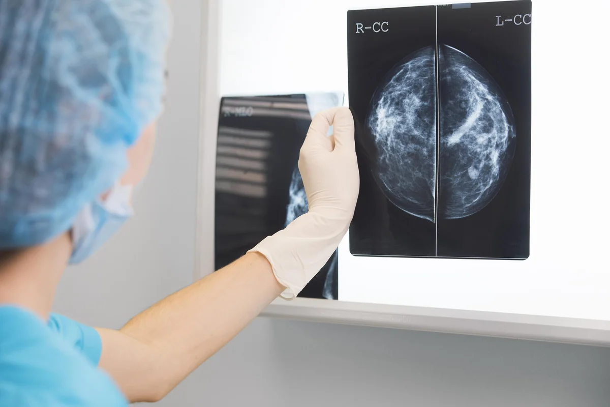 doctor holding a mammogram in front of x-ray illuminator