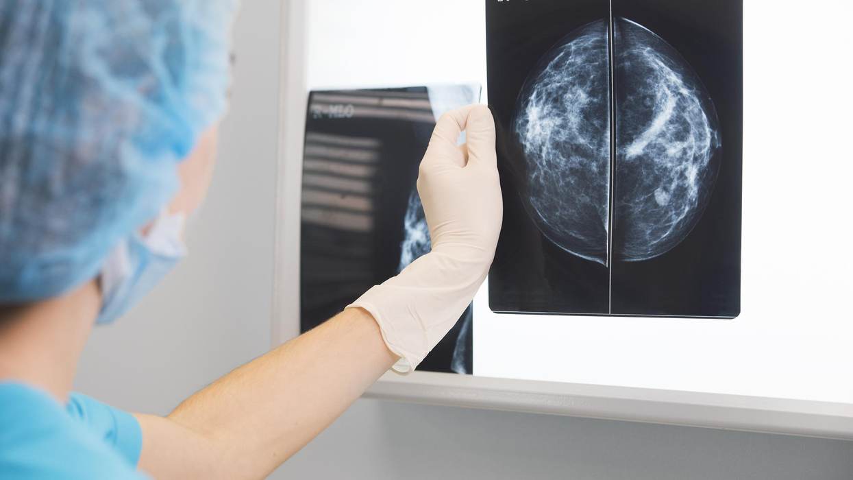 Covid-19 Vaccines and False-Positive Mammograms: When Should You Get Screened?