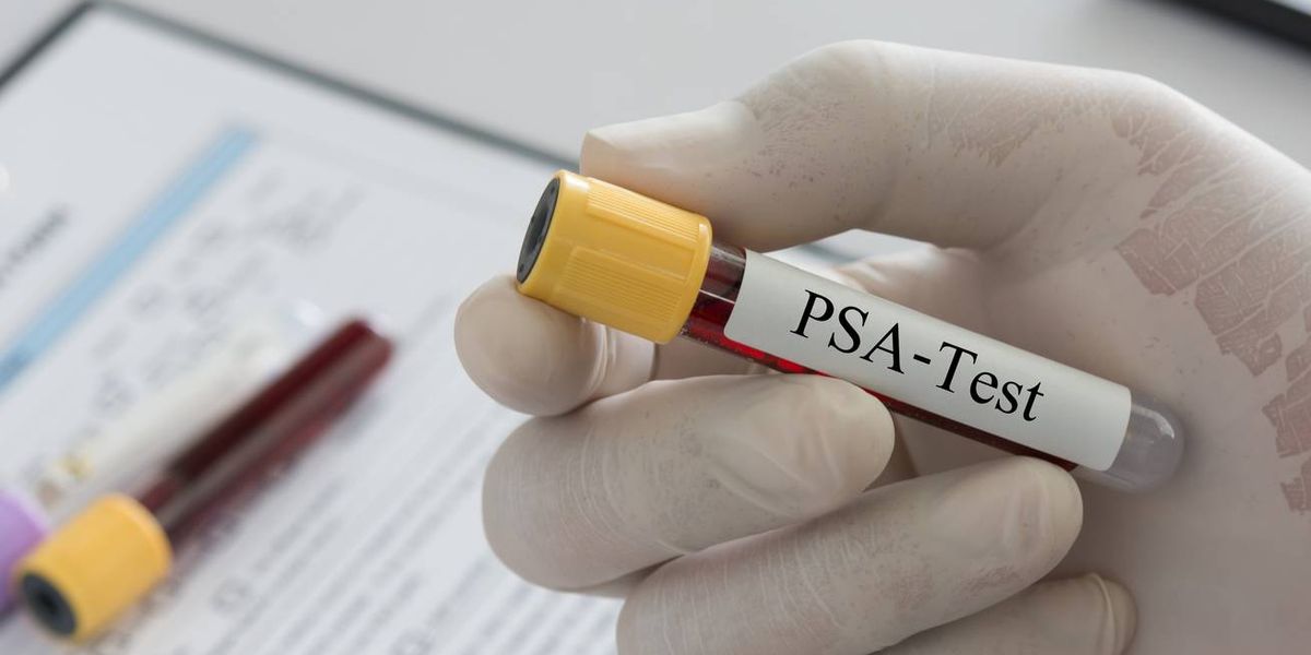 Doctor holding sample blood collection tube with PSA-Test label in lab.