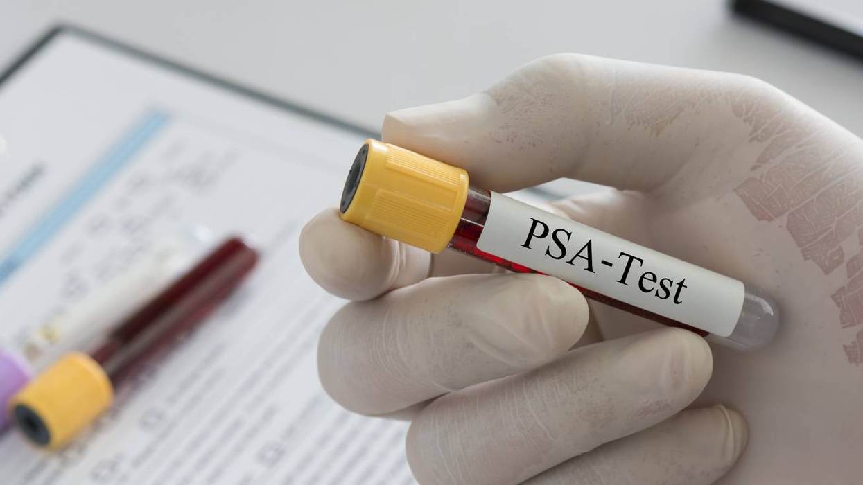 Have a Male Partner? Here’s What You Need to Know About Prostate Cancer