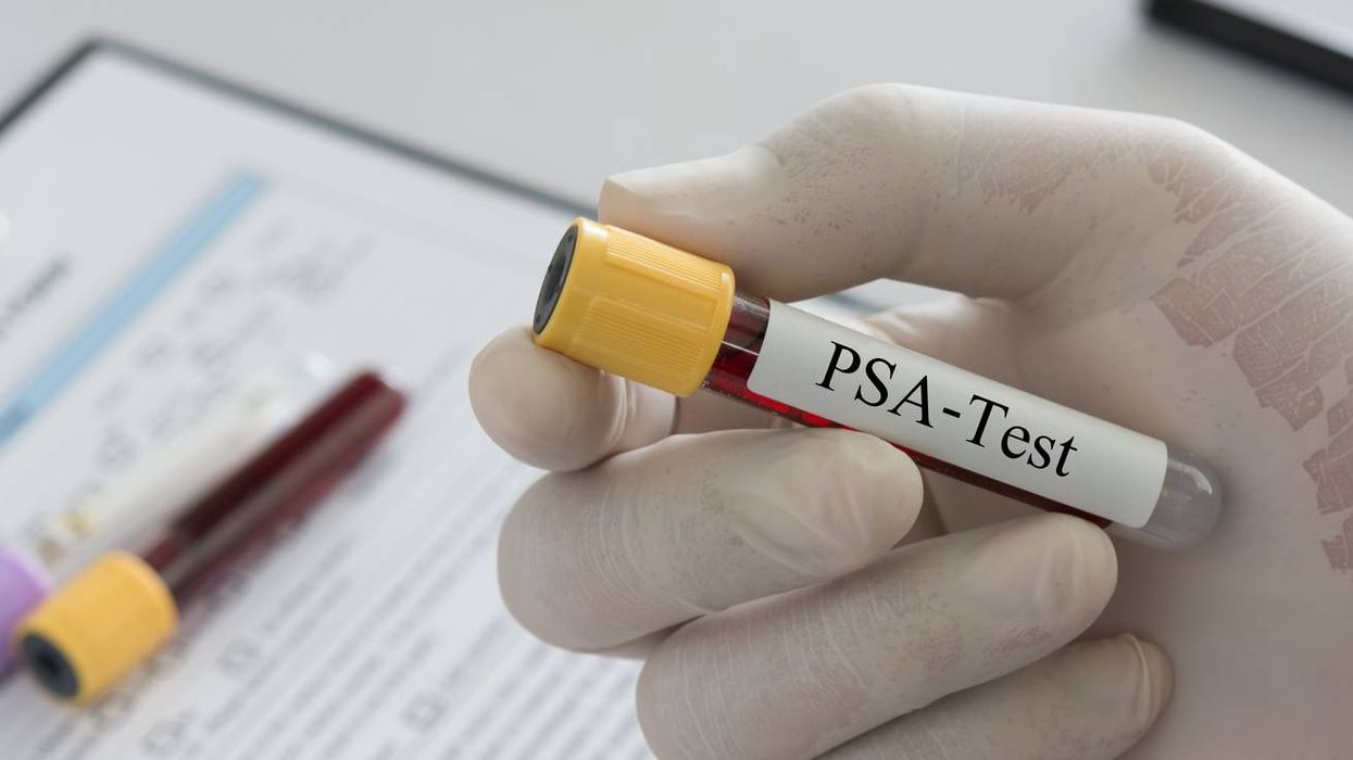 Doctor holding sample blood collection tube with PSA-Test label in lab.
