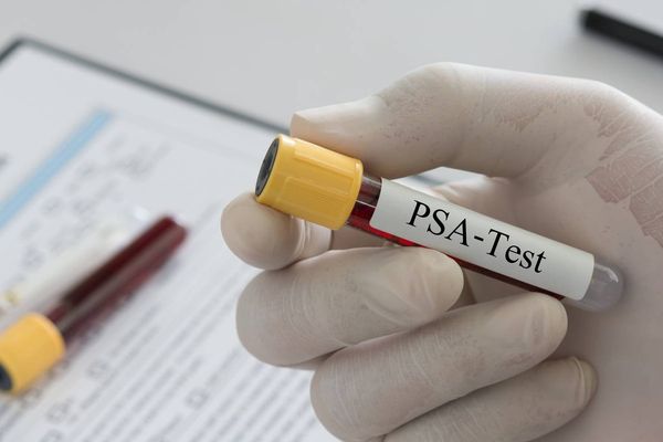 Doctor holding sample blood collection tube with PSA-Test label in lab.