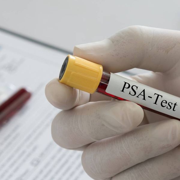 Doctor holding sample blood collection tube with PSA-Test label in lab.