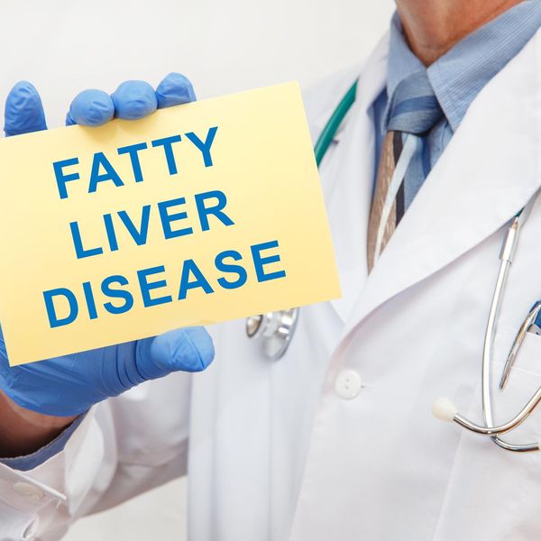 Doctor holding sign with text FATTY LIVER DISEASE