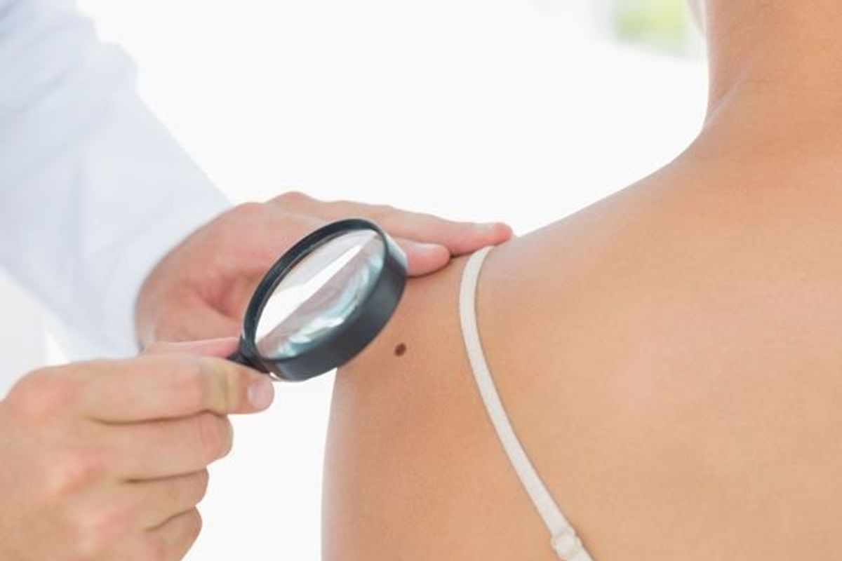 doctor inspecting a mole on a womans shoulder