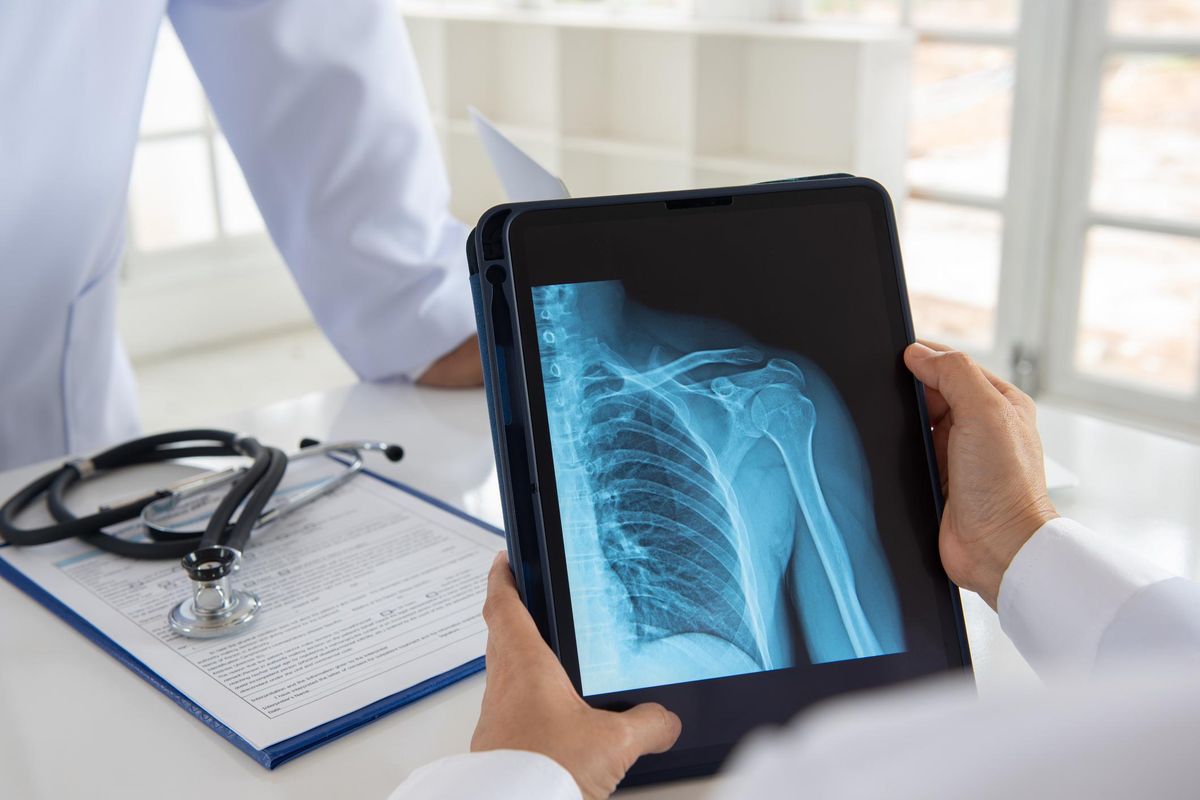 doctor looking at an x-ray