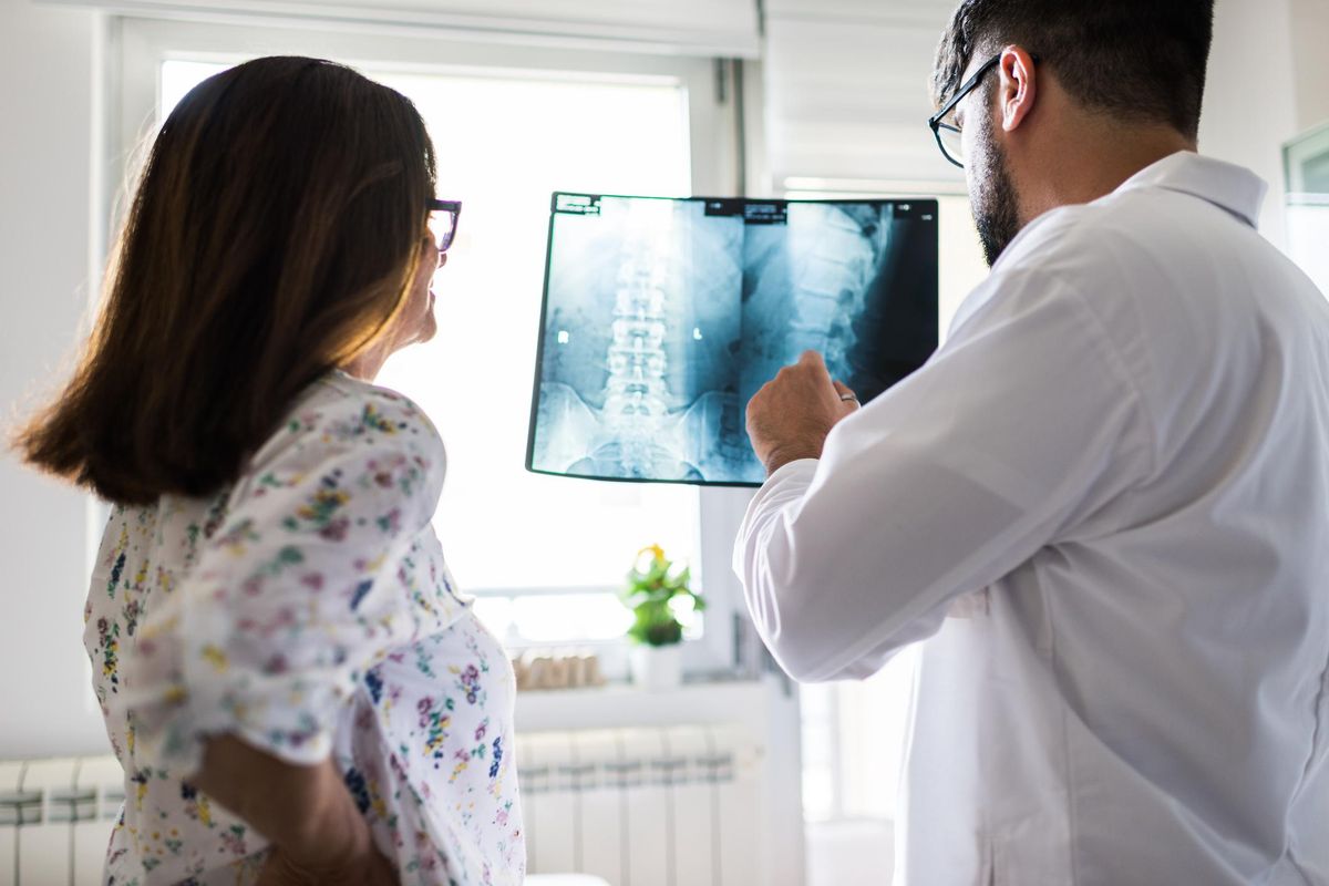 doctor looking at spinal xray