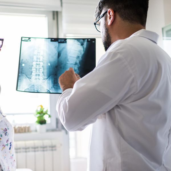 doctor looking at spinal xray
