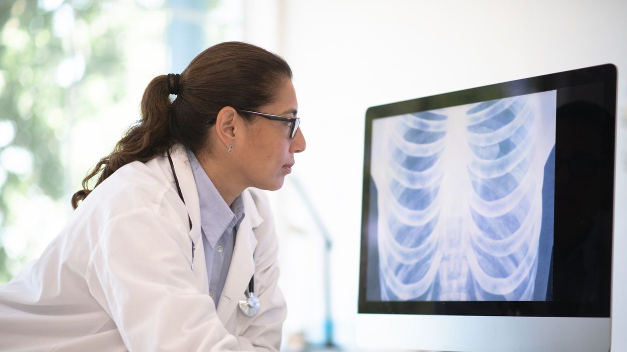 doctor of latino ethnicity leans on her desk and looks at a radiogram of a chest on her desktop computer.
