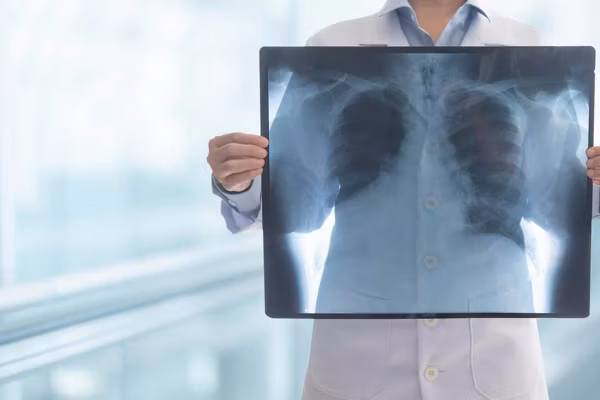 Doctor radiology looking chest or lung x-ray images at hospital ward to diagnose lung cancer