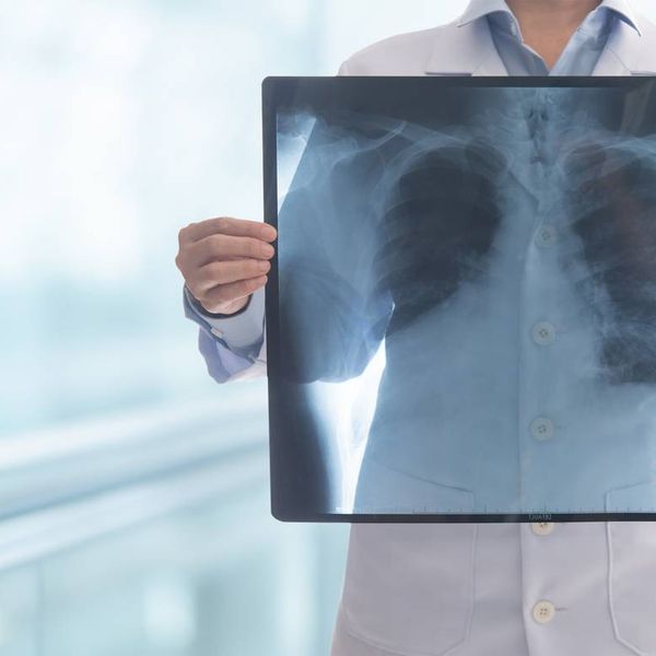Doctor radiology looking chest or lung x-ray images at hospital ward to diagnose lung cancer
