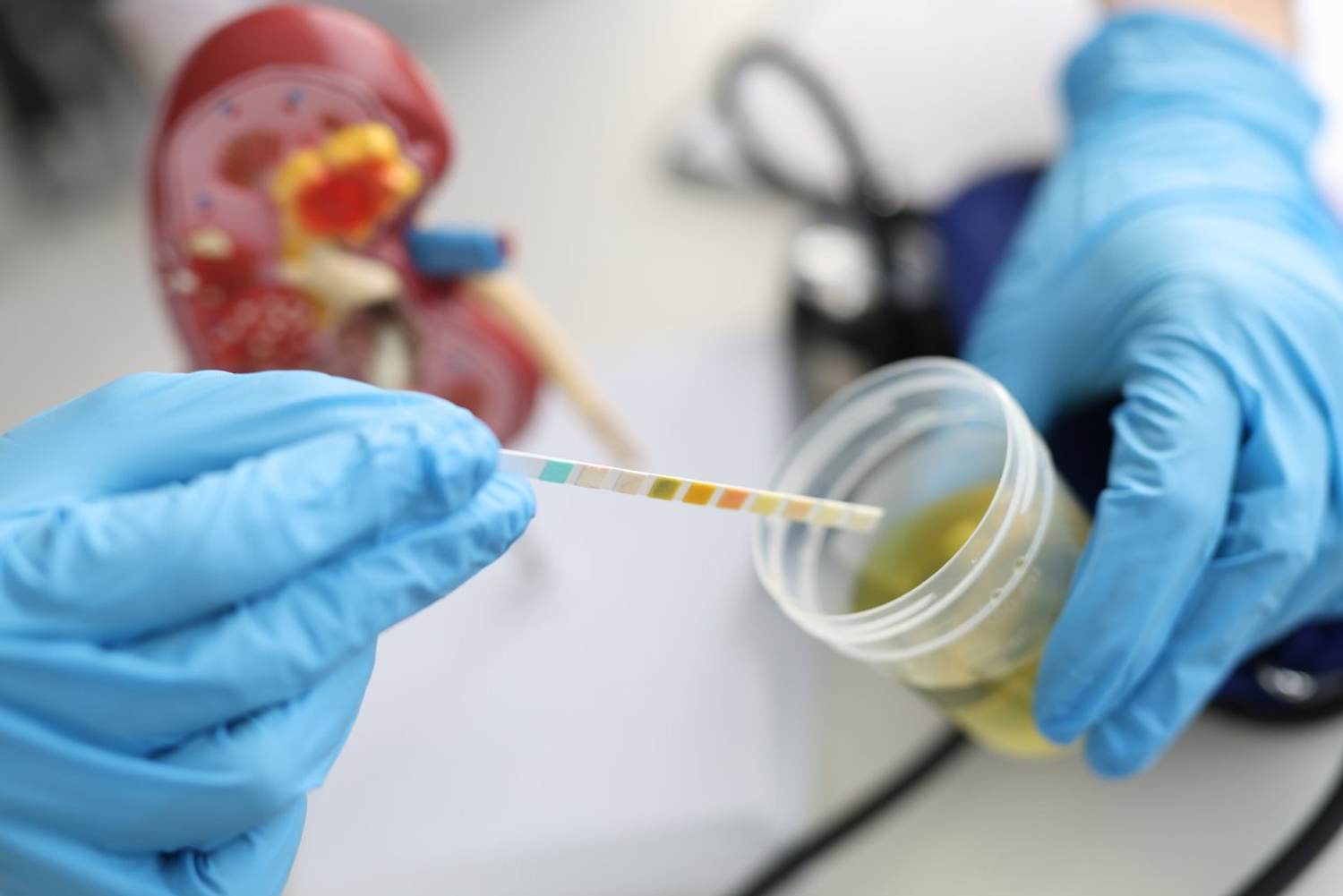 10 Reasons You Might Have Blood in Your Urine