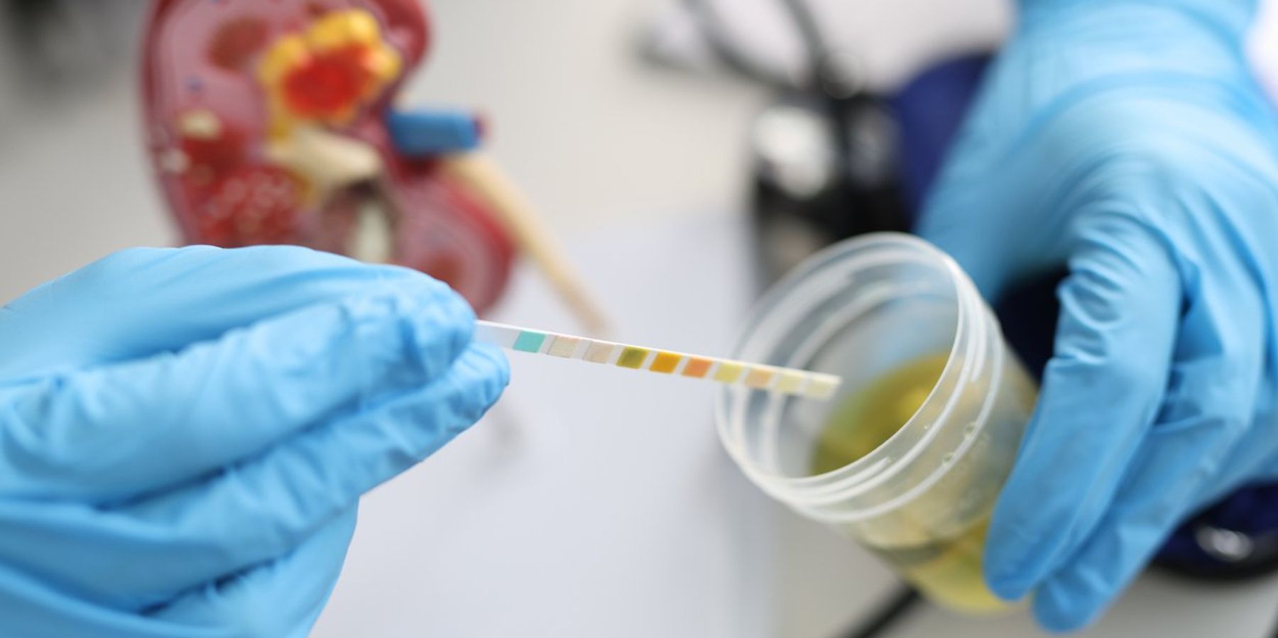 Doctor urologist making express urine test using indicator paper closeup