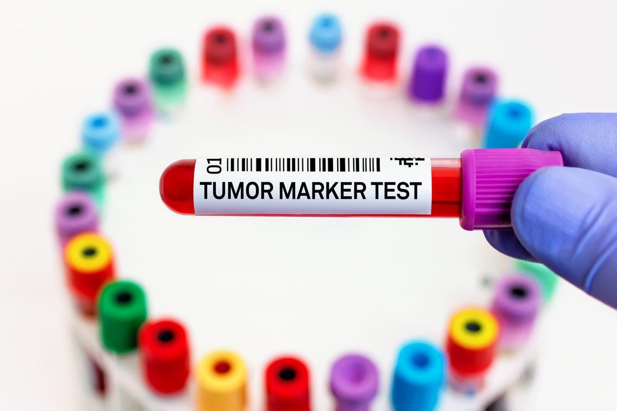 Doctor with blood tube labeled with Tumor marker for analysis of cancer biomarkers test