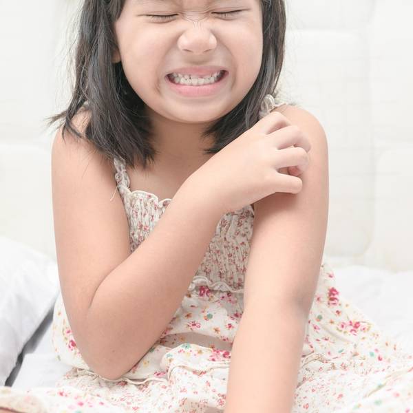 Eczema and Children: What Parents Can Do to Keep Their Kids Healthy