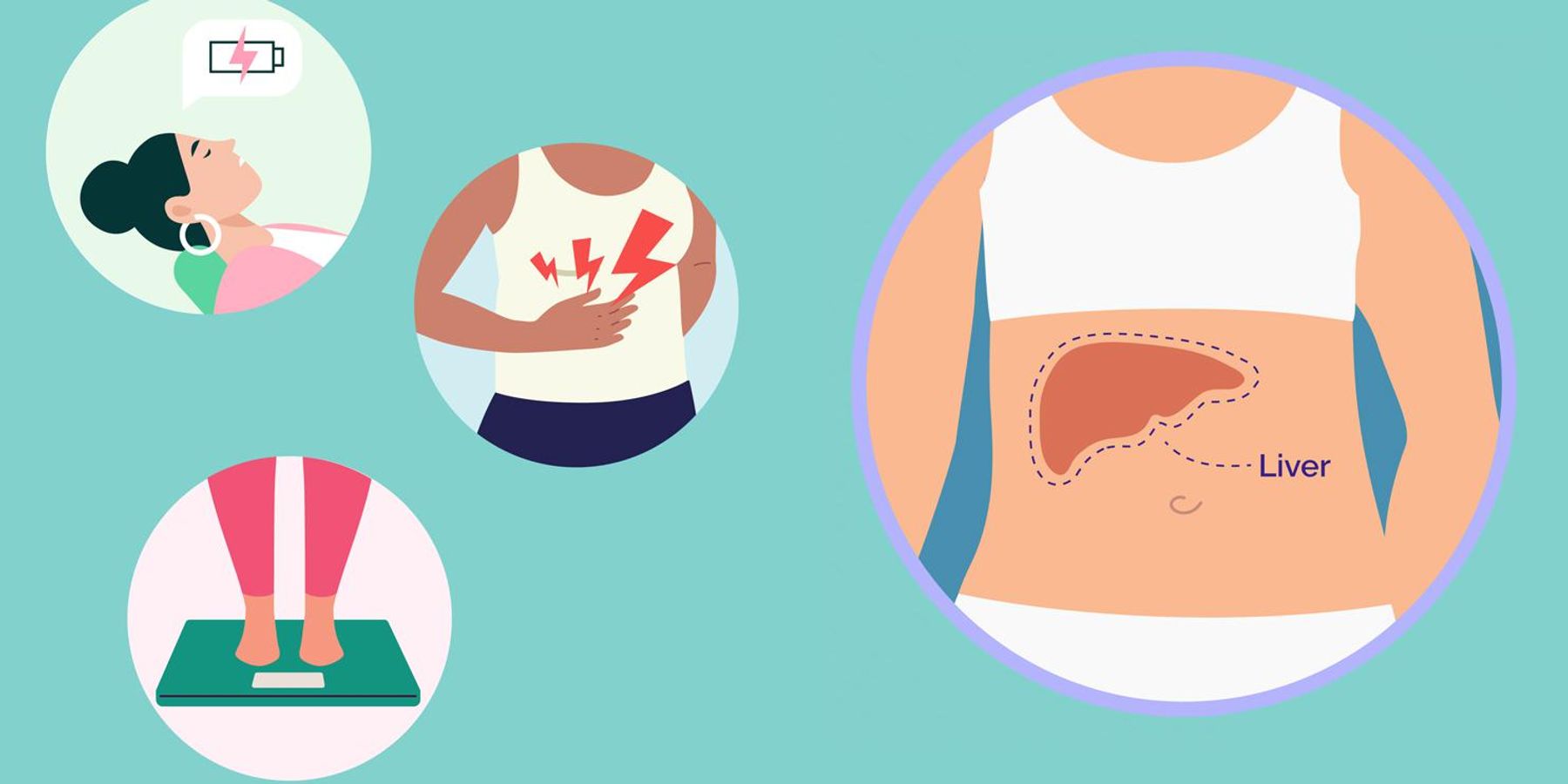 Enfermedad de hígado graso no alcohólico