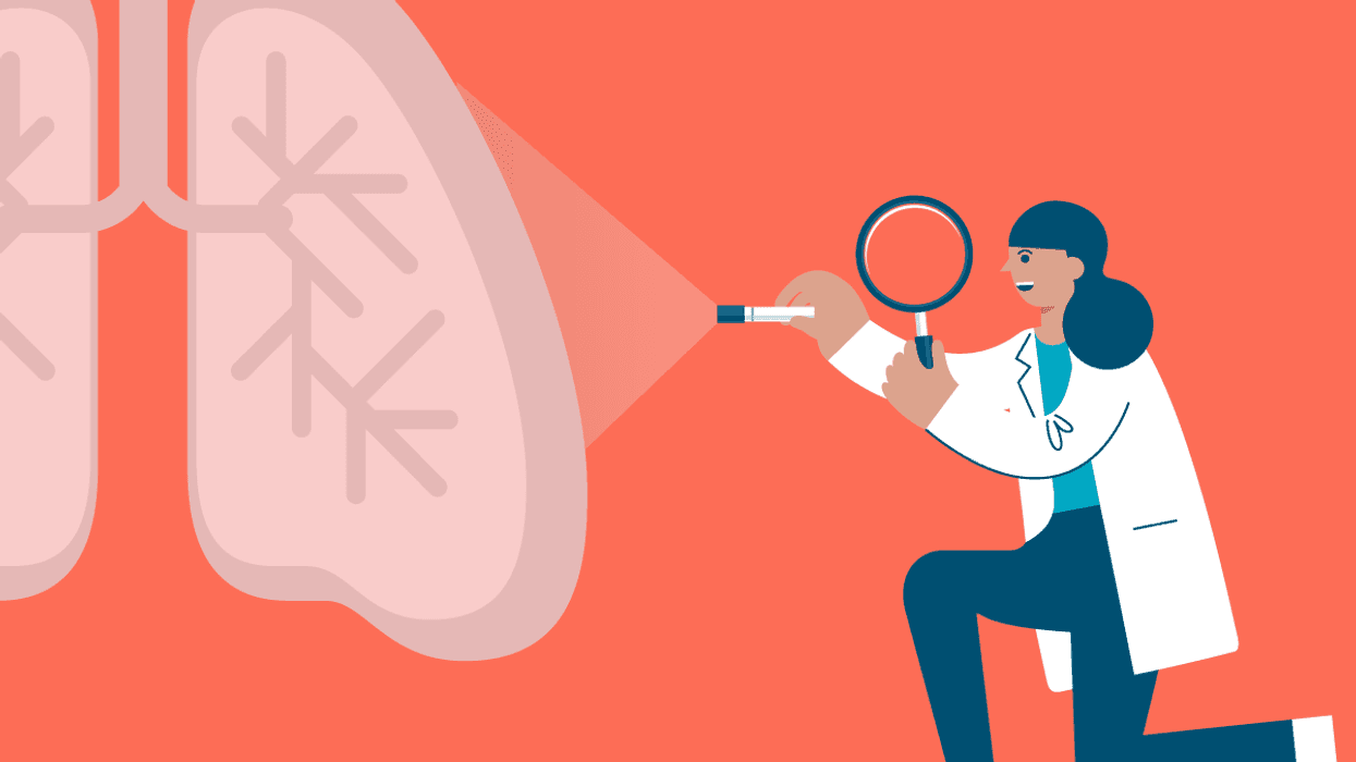 Entender los varios tipos de cáncer de pulmón