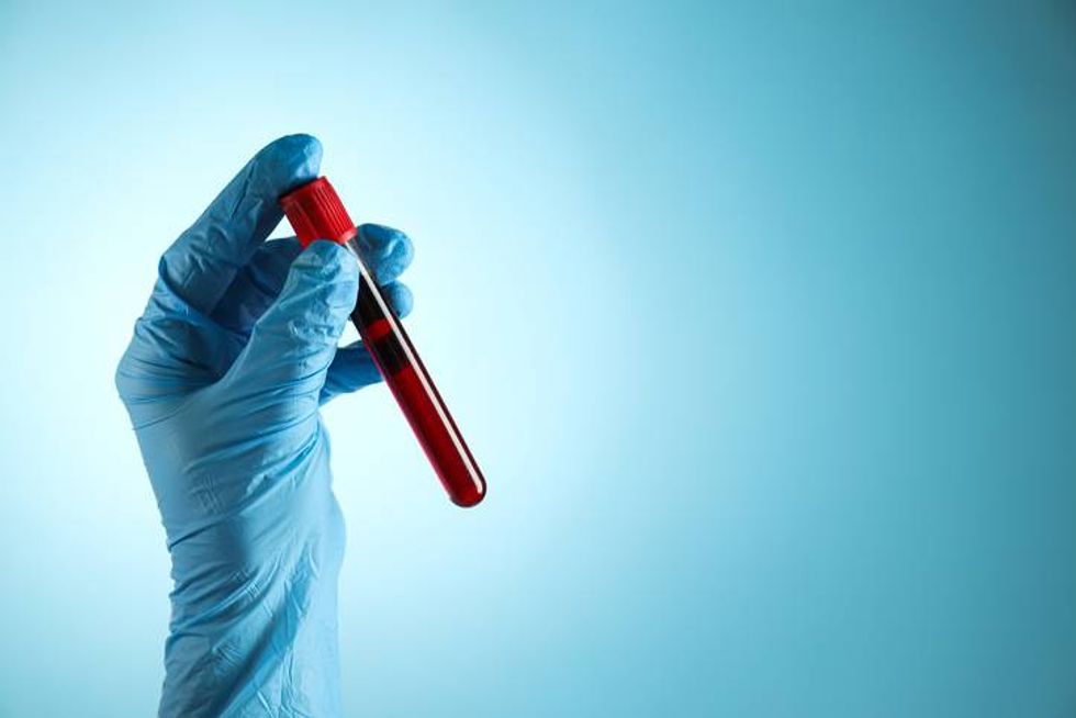 est tube with donor blood in doctor's hand