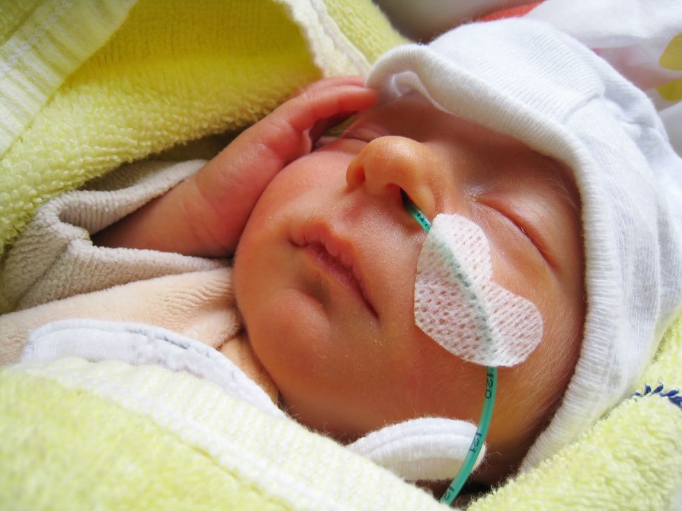 More 'Extreme Preemies' Are Surviving HealthyWomen