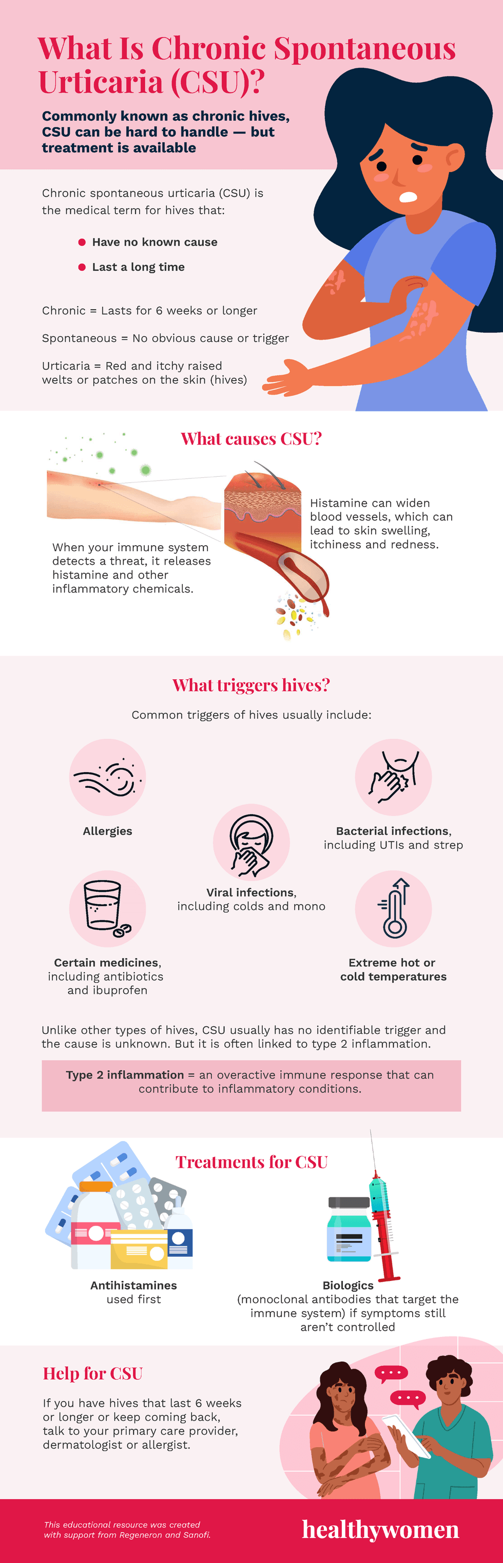 Facts About Chronic Spontaneous Urticaria infographic. click to view PDF