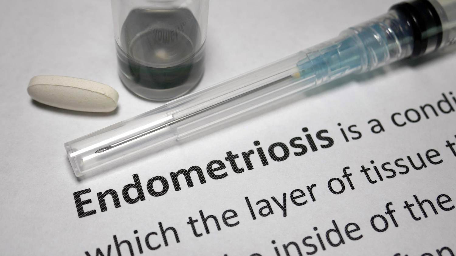 FAQs: What You Need to Know About Endometriosis