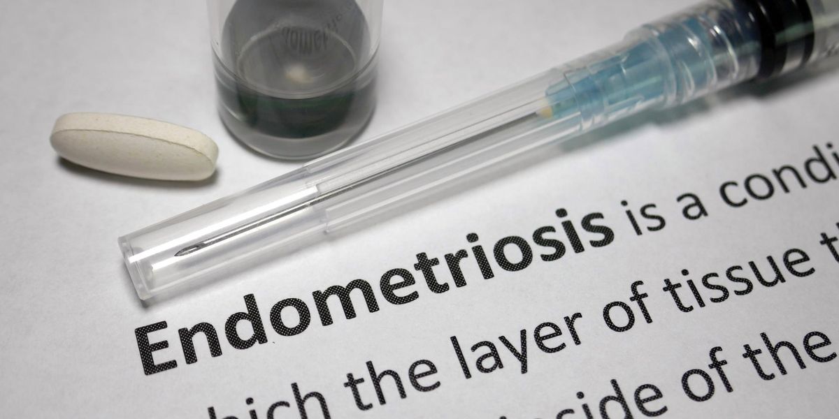 Quick Info: What You Have to Know About Endometriosis Quick Info: What You Have to Know About Endometriosis