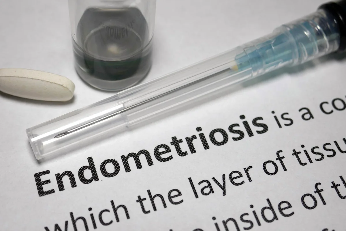 Fast Facts: What You Need to Know About Endometriosis