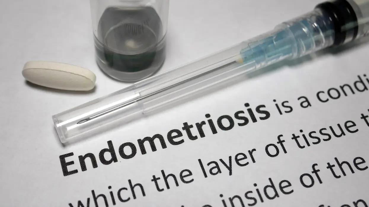 FAQs: What You Need to Know About Endometriosis