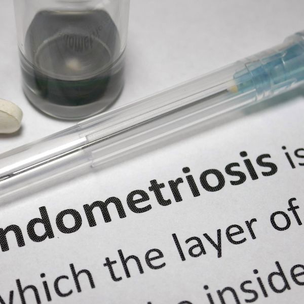Fast Facts: What You Need to Know About Endometriosis