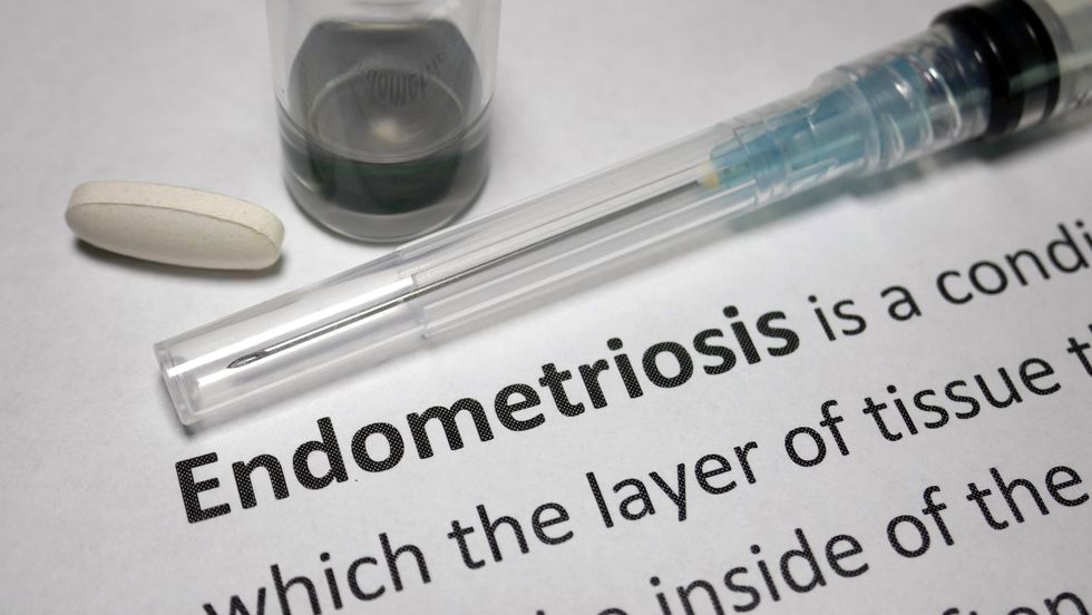 Fast Facts: What You Need to Know About Endometriosis