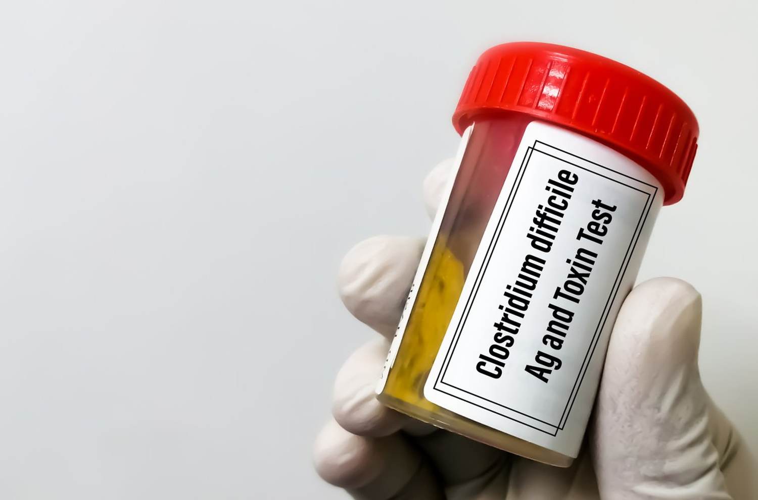 C. difficile 101