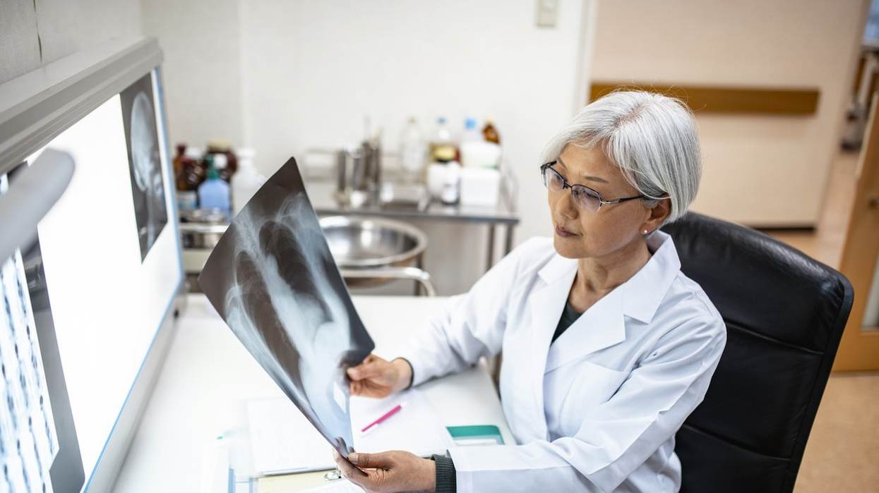 Early Screening for Lung Cancer Can Be a Lifesaver