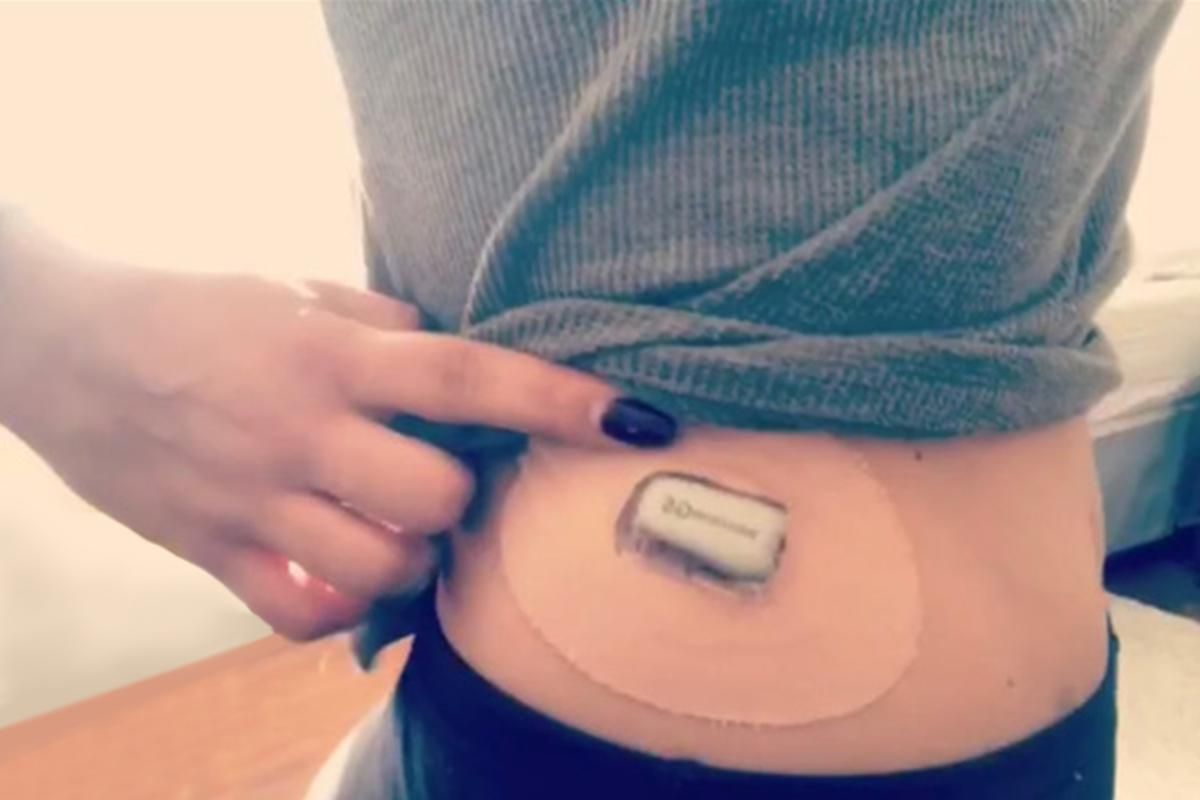 Fernandez and her continuous glucose monitor, 2019