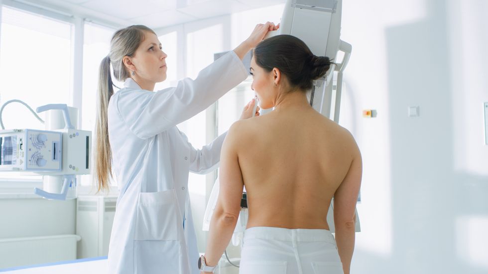 For Some Women, Mammograms May Need to Begin at 30